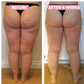 Anti-cellulite cupping- og skrabningsenhed